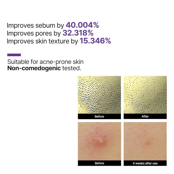 Some By Mi Retinol Intense Reactivating Serum 30Ml - Image 3